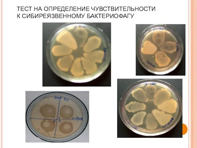 ТЕСТ НА ОПРЕДЕЛЕНИЕ ЧУВСТВИТЕЛЬНОСТИ К СИБИРЕЯЗВЕННОМУ БАКТЕРИОФАГУ