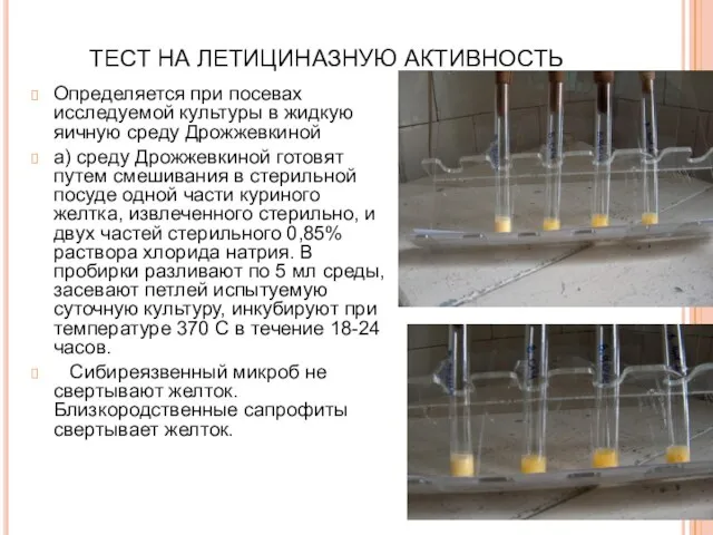 ТЕСТ НА ЛЕТИЦИНАЗНУЮ АКТИВНОСТЬ Определяется при посевах исследуемой культуры в жидкую