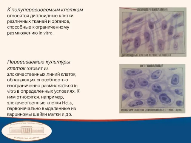 К полуперевиваемым клеткам относятся диплоидные клетки различных тканей и органов, способные