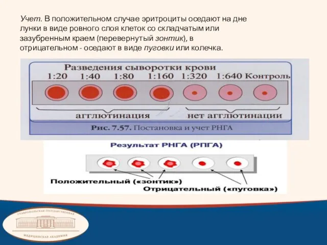 Учет. В положительном случае эритроциты оседают на дне лунки в виде