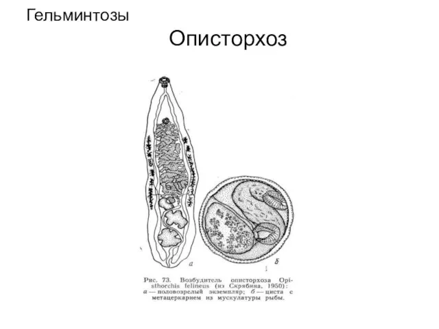 Гельминтозы Описторхоз