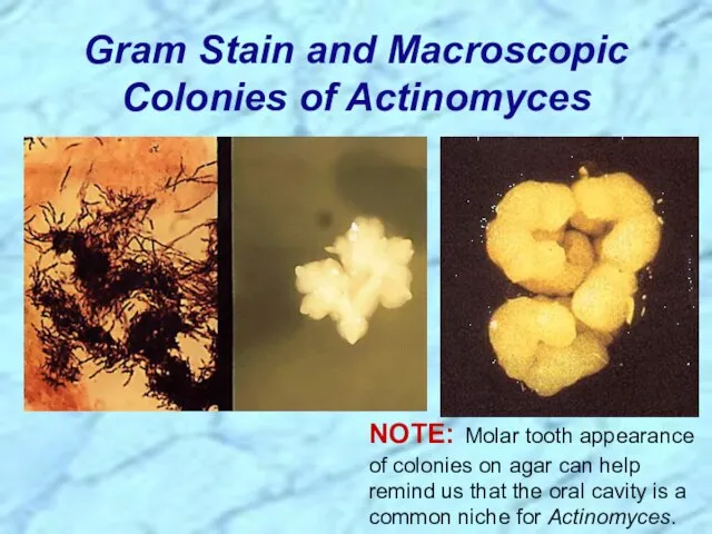 Gram Stain and Macroscopic Colonies of Actinomyces NOTE: Molar tooth appearance