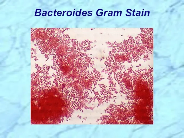 Bacteroides Gram Stain