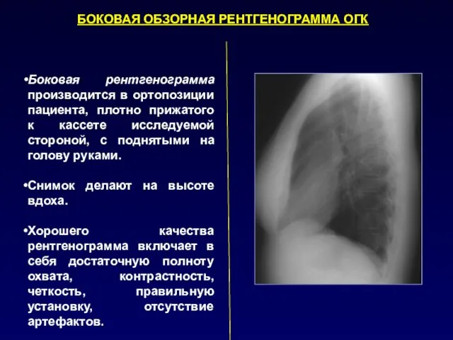 Боковая рентгенограмма производится в ортопозиции пациента, плотно прижатого к кассете исследуемой