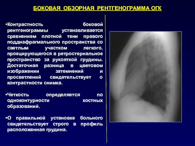 Контрастность боковой рентгенограммы устанавливается сравнением плотной тени правого поддиафрагмального пространства со