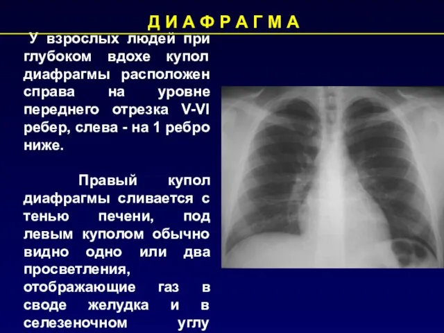 У взрослых людей при глубоком вдохе купол диафрагмы расположен справа на