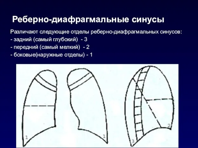 Реберно-диафрагмальные синусы Различают следующие отделы реберно-диафрагмальных синусов: - задний (самый глубокий)