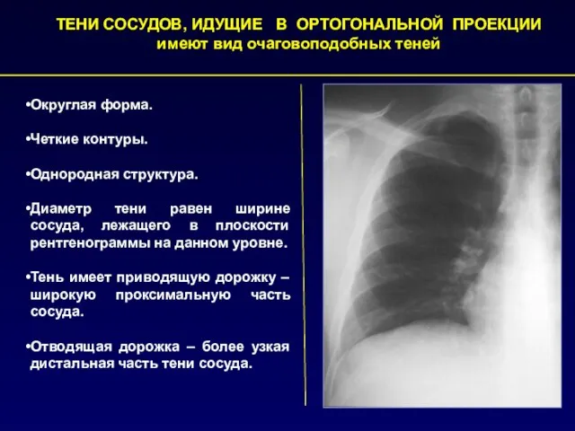 Округлая форма. Четкие контуры. Однородная структура. Диаметр тени равен ширине сосуда,