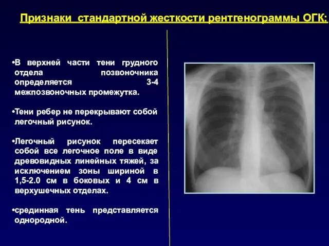 Признаки стандартной жесткости рентгенограммы ОГК: В верхней части тени грудного отдела