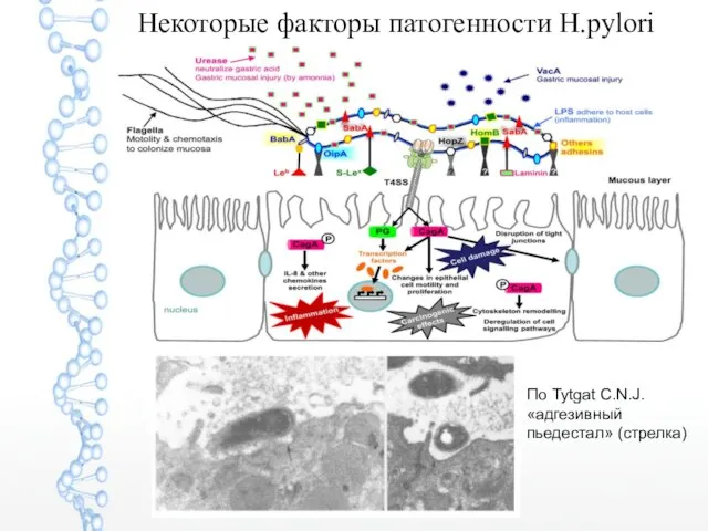 Некоторые факторы патогенности H.pylori По Tytgat C.N.J. «адгезивный пьедестал» (стрелка)