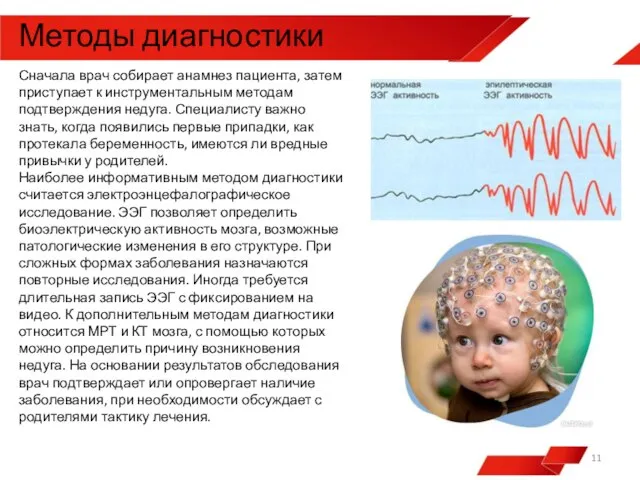 Сначала врач собирает анамнез пациента, затем приступает к инструментальным методам подтверждения