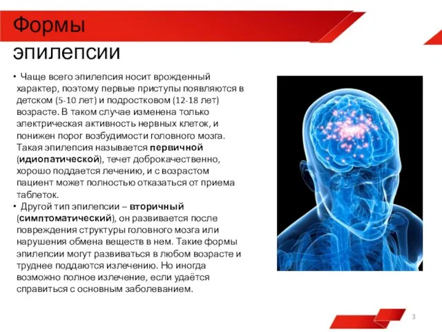 Чаще всего эпилепсия носит врожденный характер, поэтому первые приступы появляются в