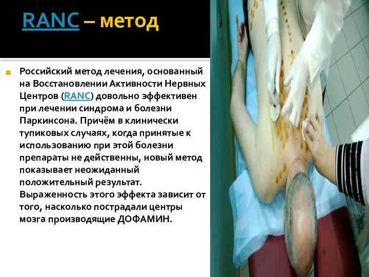 RANC – метод Российский метод лечения, основанный на Восстановлении Активности Нервных