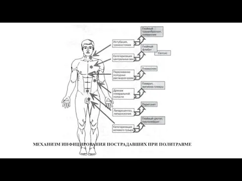 МЕХАНИЗМ ИНФИЦИРОВАНИЯ ПОСТРАДАВШИХ ПРИ ПОЛИТРАВМЕ