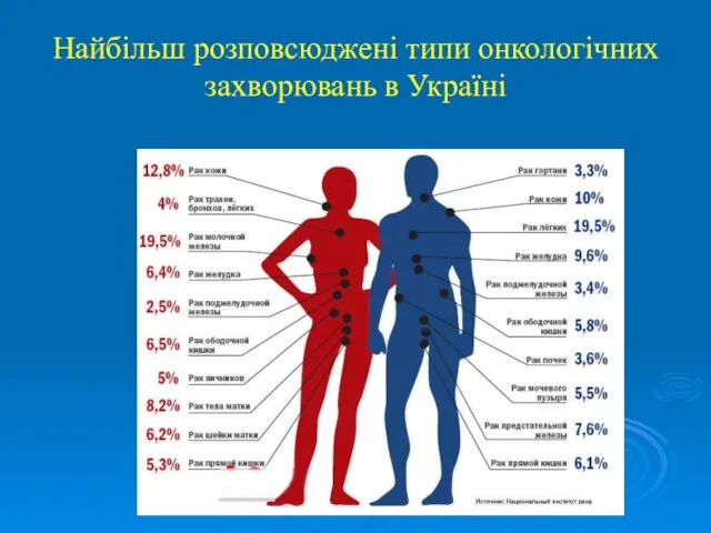 Найбільш розповсюджені типи онкологічних захворювань в Україні