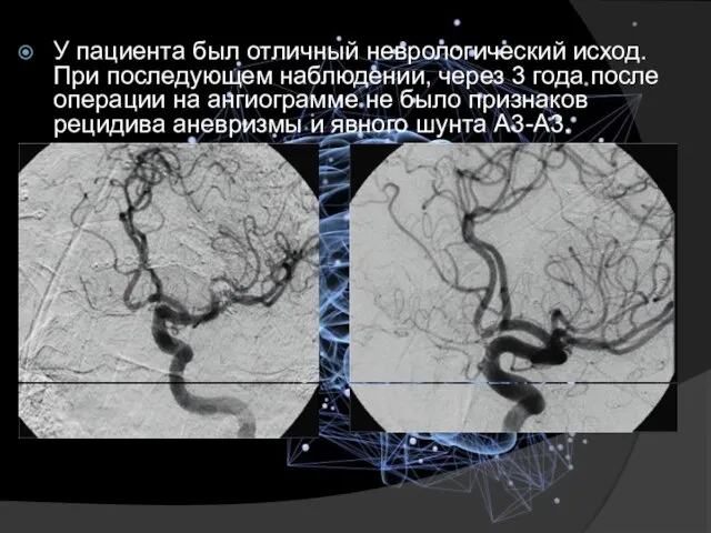 У пациента был отличный неврологический исход. При последующем наблюдении, через 3