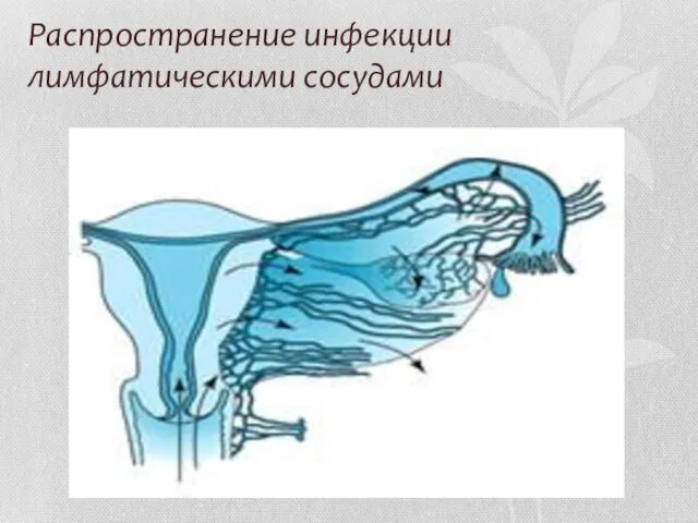 Распространение инфекции лимфатическими сосудами