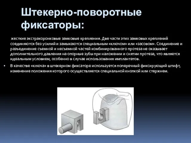 Штекерно-поворотные фиксаторы: жесткие экстракоронковые замковые крепления. Две части этих замковых креплений