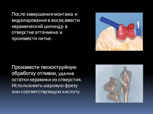 После завершения монтажа и моделирования в воске,ввести керамический цилиндр в отверстие