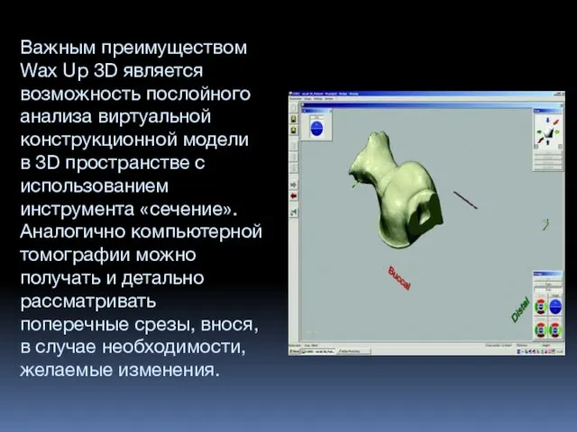 Важным преимуществом Wax Up 3D является возможность послойного анализа виртуальной конструкционной