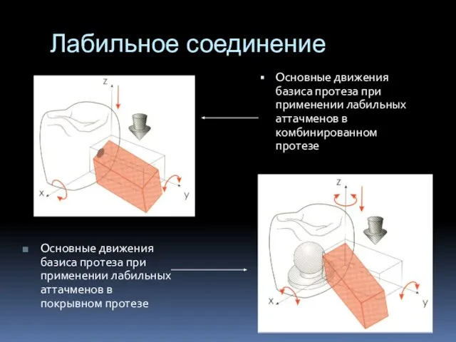 Лабильное соединение Основные движения базиса протеза при применении лабильных аттачменов в