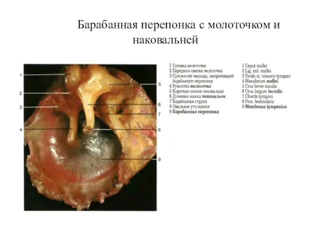 Барабанная перепонка с молоточком и наковальней