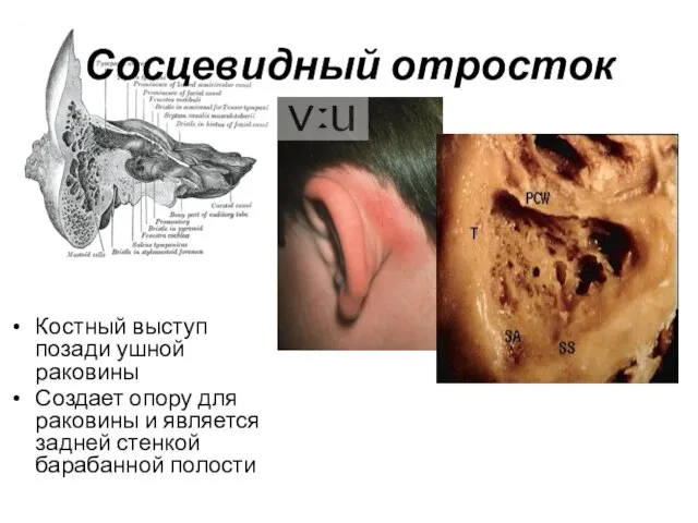 Сосцевидный отросток Костный выступ позади ушной раковины Создает опору для раковины