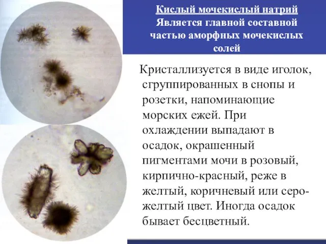 Кислый мочекислый натрий Является главной составной частью аморфных мочекислых солей Кристаллизуется