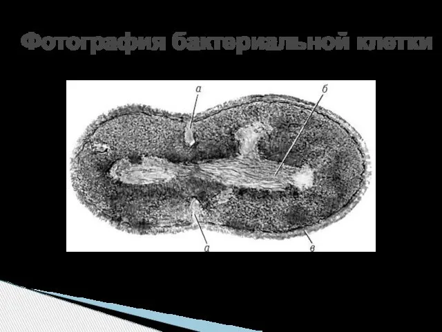 Фотография бактериальной клетки