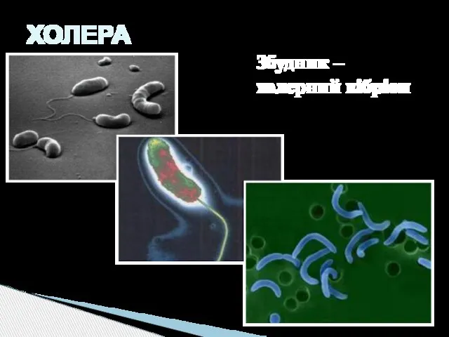 ХОЛЕРА Збудник – холерний вібріон
