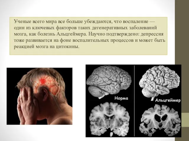 Ученые всего мира все больше убеждаются, что воспаление — один из