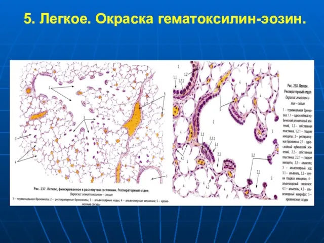 5. Легкое. Окраска гематоксилин-эозин.