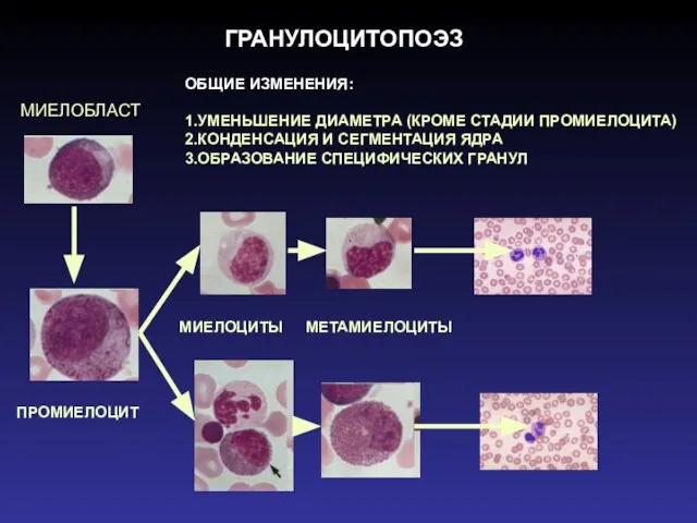 ГРАНУЛОЦИТОПОЭЗ МИЕЛОБЛАСТ ПРОМИЕЛОЦИТ МИЕЛОЦИТЫ МЕТАМИЕЛОЦИТЫ ОБЩИЕ ИЗМЕНЕНИЯ: 1.УМЕНЬШЕНИЕ ДИАМЕТРА (КРОМЕ СТАДИИ