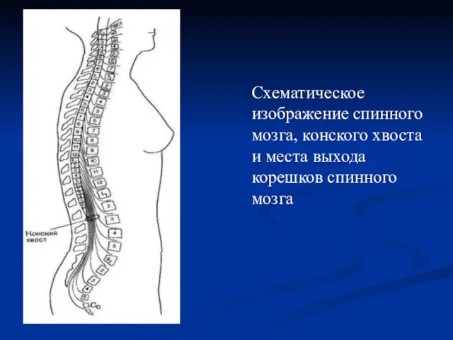 Схематическое изображение спинного мозга, конского хвоста и места выхода корешков спинного мозга