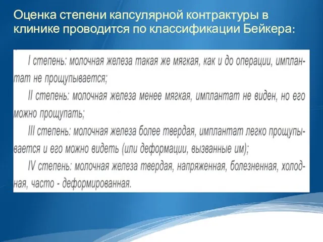 Оценка степени капсулярной контрактуры в клинике проводится по классификации Бейкера: