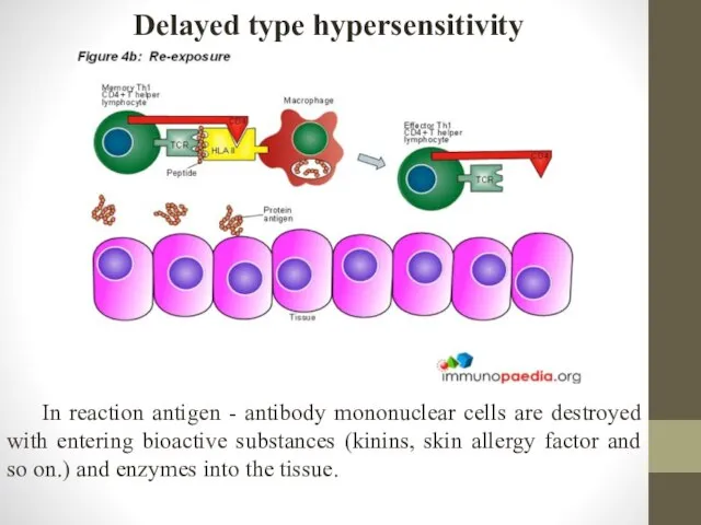 Delayed type hypersensitivity In reaction antigen - antibody mononuclear cells are