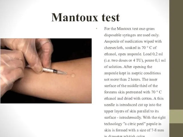 Mantoux test For the Mantoux test one-gram disposable syringes are used