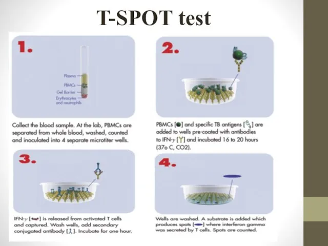 T-SPOT test