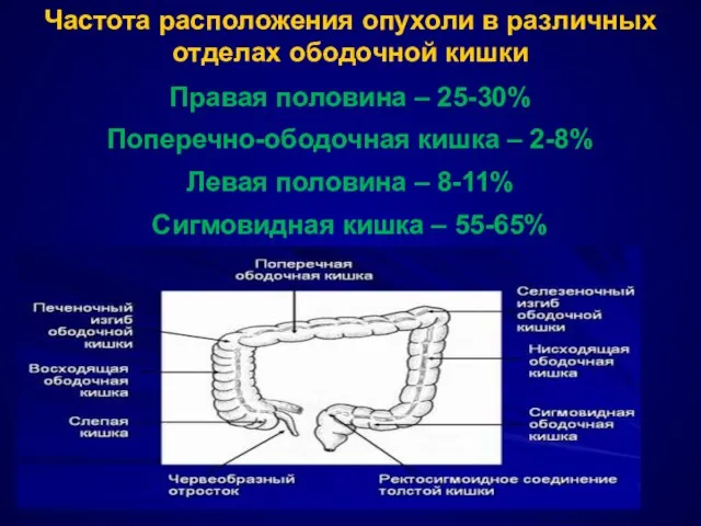 Частота расположения опухоли в различных отделах ободочной кишки Правая половина –