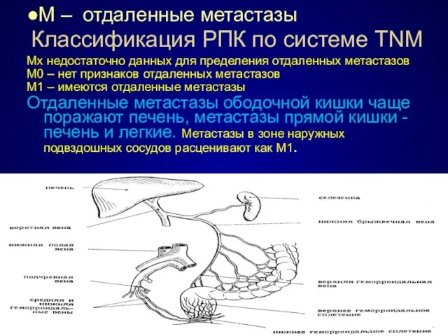 Классификация РПК по системе TNM ●М – отдаленные метастазы Мх недостаточно