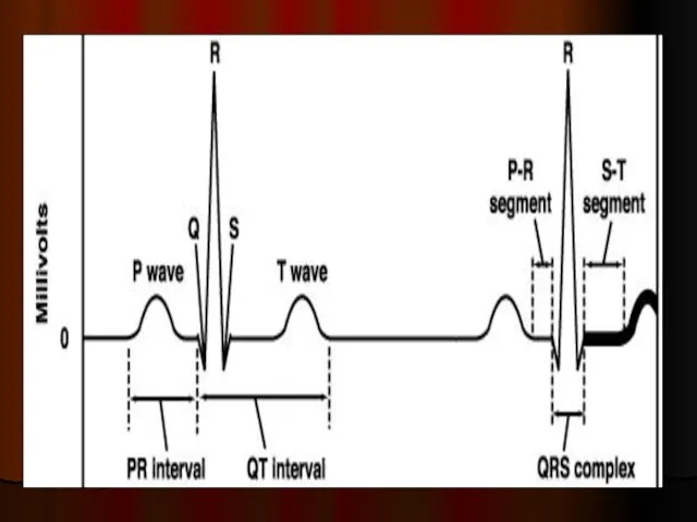 EKG