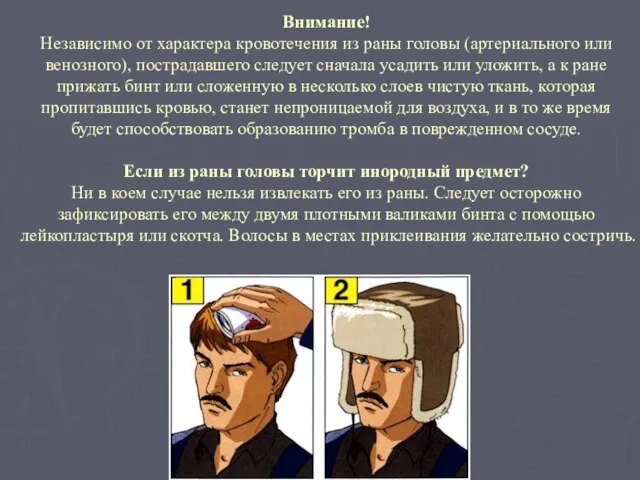 Внимание! Независимо от характера кровотечения из раны головы (артериального или венозного),