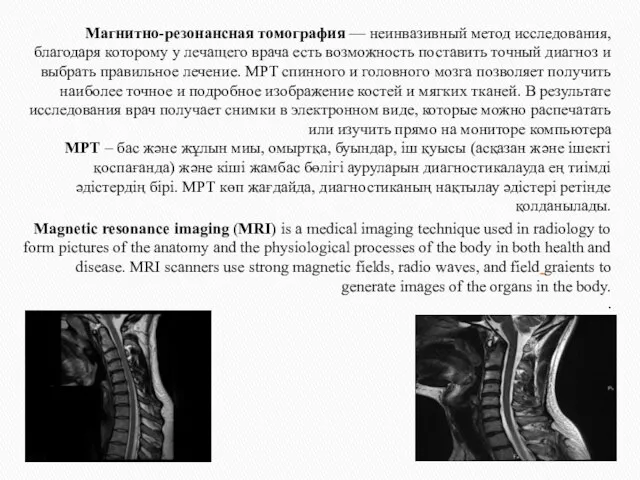 Магнитно-резонансная томография — неинвазивный метод исследования, благодаря которому у лечащего врача
