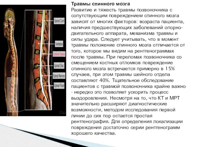 Травмы спинного мозга Развитие и тяжесть травмы позвоночника с сопутствующим повреждением