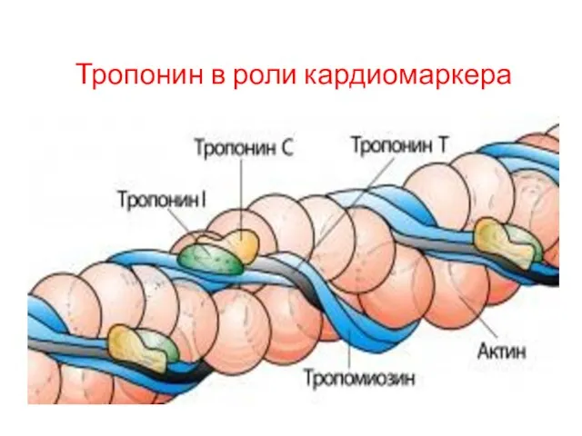 Тропонин в роли кардиомаркера