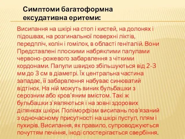 Симптоми багатоформна ексудативна еритеми: Висипання на шкірі на стоп і кистей,