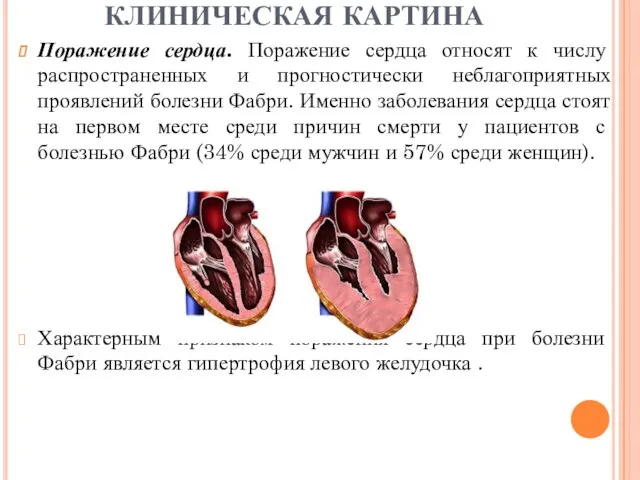 Поражение сердца. Поражение сердца относят к числу распространенных и прогностически неблагоприятных