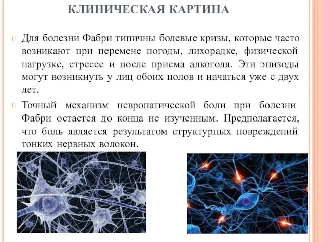 Для болезни Фабри типичны болевые кризы, которые часто возникают при перемене