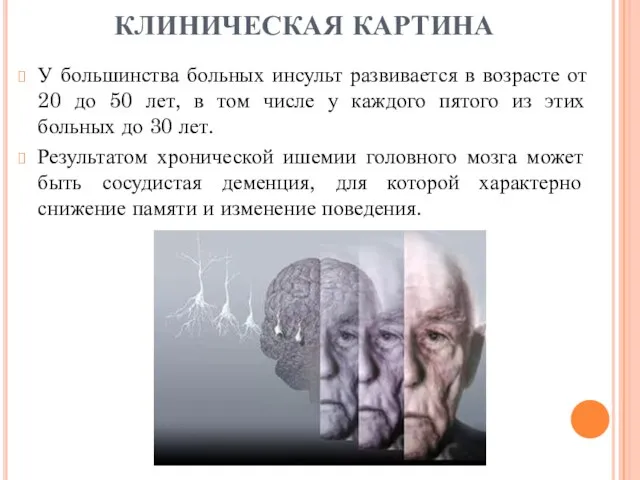 У большинства больных инсульт развивается в возрасте от 20 до 50