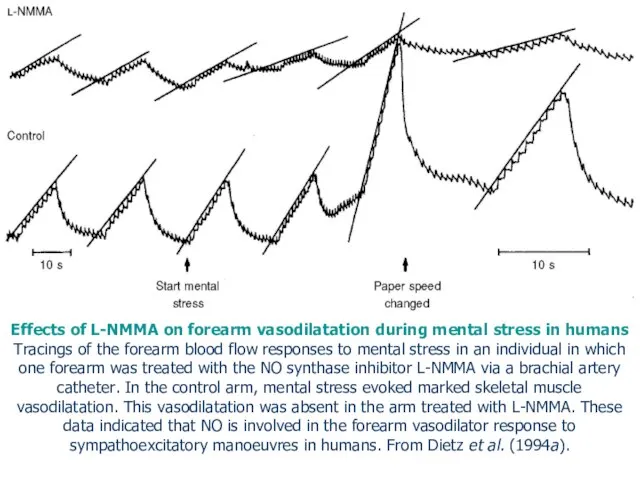 Effects of L-NMMA on forearm vasodilatation during mental stress in humans